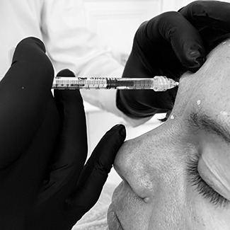 Injections visage Botox Lyon